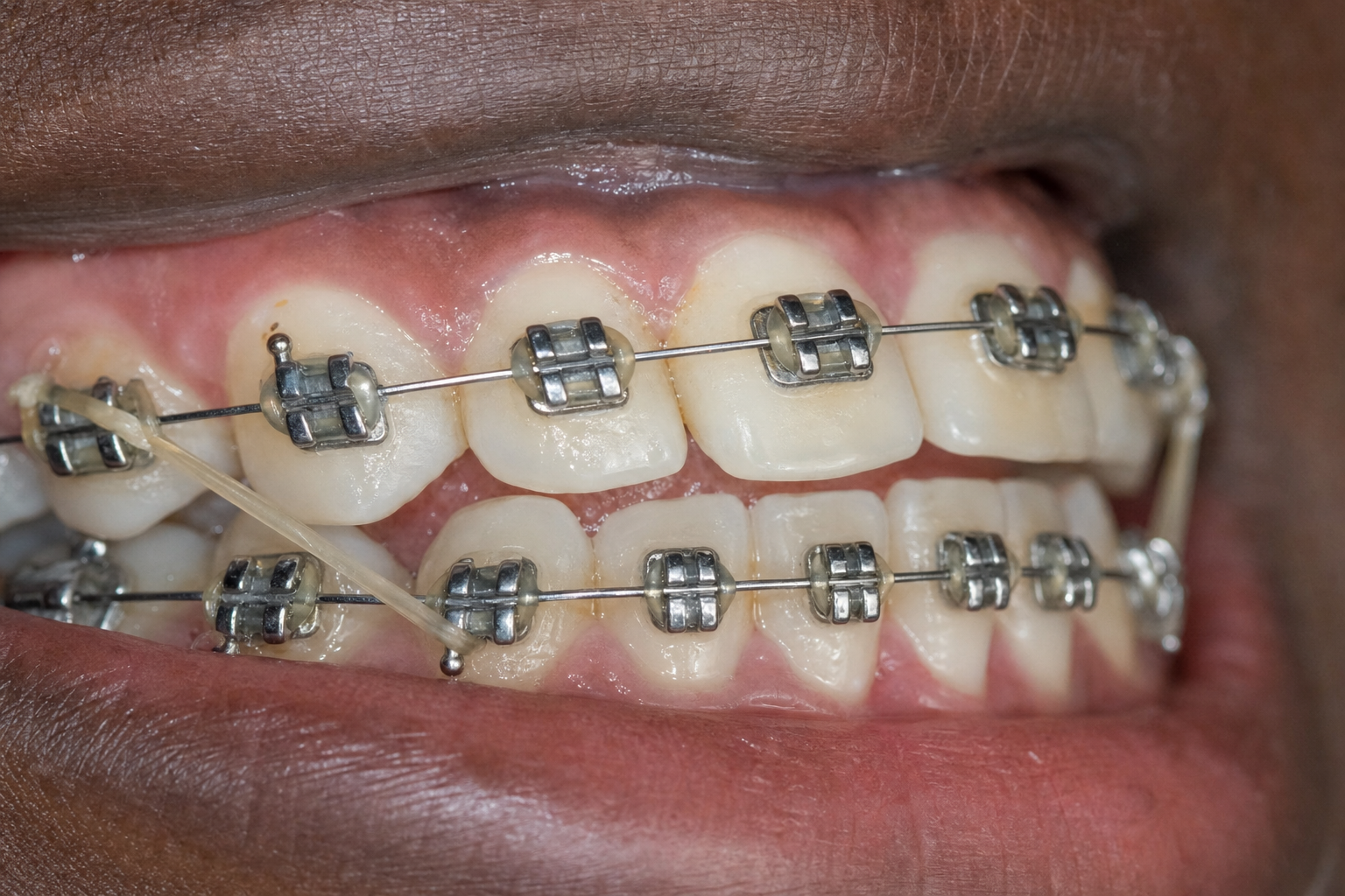 Proven precision, lasting results.
